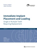Cover: Immediate Implant Placement and Loading - Quintessenz Verlag