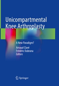 Abbildung von: Unicompartmental Knee Arthroplasty - Springer