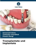Cover: Transplantate und Implantate - Verlag Unser Wissen