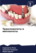 Cover: Transplantaty i implantaty - Sciencia Scripts