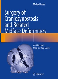 Abbildung von: Surgery of Craniosynostosis and Related Midface Deformities - Springer