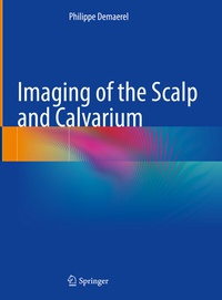 Abbildung von: Imaging of the Scalp and Calvarium - Springer