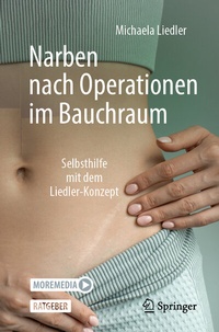 Abbildung von: Narben nach Operationen im Bauchraum - Springer