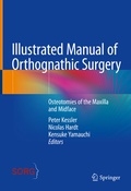 Cover: Illustrated Manual of Orthognathic Surgery - Springer