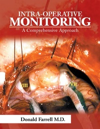 Abbildung von: Intra-Operative Monitoring - Xlibris Us