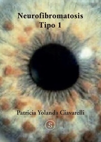 Abbildung von: Neurofibromatosis Tipo 1 - Ediciones Servicop