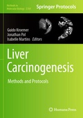 Cover: Liver Carcinogenesis - Humana