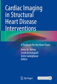 Abbildung von: Cardiac Imaging in Structural Heart Disease Interventions - Springer