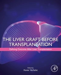Abbildung von: The Liver Graft Before Transplantation - Academic Press