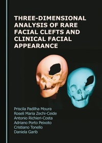 Abbildung von: Three-Dimensional Analysis of Rare Facial Clefts and Clinical Facial Appearance - Cambridge Scholars Publishing