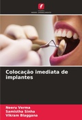 Cover: Colocacao imediata de implantes - Edicoes Nosso Conhecimento