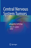 Cover: Central Nervous System Tumors - Springer