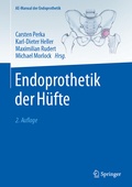 Cover: Endoprothetik der H&uuml;fte - Springer
