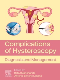 Abbildung von: Complications of Hysteroscopy - Elsevier