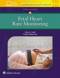 Enlarge image Cover: Fetal Heart Rate Monitoring - WOLTERS KLUWER HEALTH