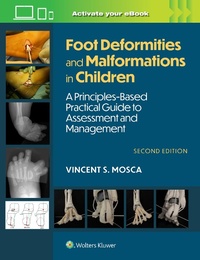 Abbildung von: Foot Deformities and Malformations in Children - WOLTERS KLUWER HEALTH