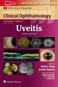 Cover: Uveitis - WOLTERS KLUWER HEALTH