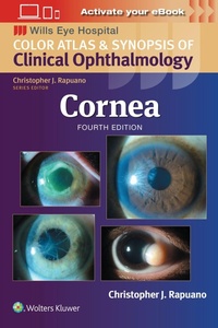 Enlarge image Cover: Cornea: Print + eBook with Multimedia - WOLTERS KLUWER HEALTH