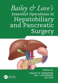 Cover: Bailey & Love's Essential Operations in Hepatobiliary and Pancreatic Surgery - CRC Press