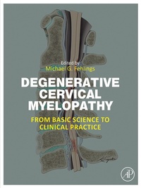 Abbildung von: Degenerative Cervical Myelopathy - Academic Press