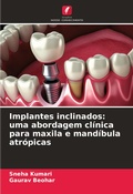Cover: Implantes inclinados - Edicoes Nosso Conhecimento