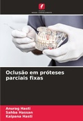 Cover: Oclus&atilde;o em pr&oacute;teses parciais fixas - Edi&ccedil;&otilde;es Nosso Conhecimento