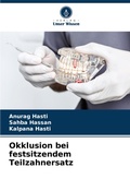 Cover: Okklusion bei festsitzendem Teilzahnersatz - Verlag Unser Wissen