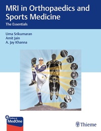 Abbildung von: MRI in Orthopaedics and Sports Medicine - Thieme Publishers