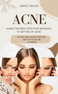 Abbildung von: Acne - Sidney Travis