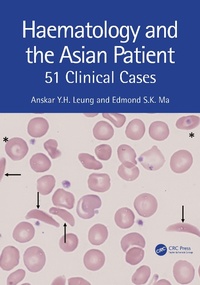 Abbildung von: Haematology and the Asian Patient - CRC Press
