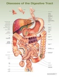 Cover: Diseases of the Digestive Tract Anatomical Chart - WOLTERS KLUWER HEALTH