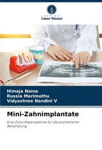 Abbildung von: Mini-Zahnimplantate - Verlag Unser Wissen