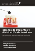 Cover: Dise&ntilde;os de implantes y distribuci&oacute;n de tensiones - Ediciones Nuestro Conocimiento