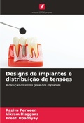 Cover: Designs de implantes e distribuicao de tensoes - Edicoes Nosso Conhecimento