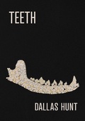 Cover: Teeth - Nightwood Editions