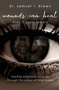 Cover: Wounds Can Heal, Even If Scars Remain - S.H.E. Publishing, LLC