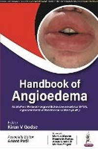 Enlarge image Cover: Handbook of Angioedema - Jaypee Brothers Medical Publishers
