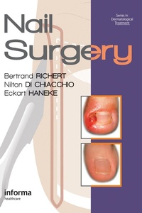 Abbildung von: Nail Surgery - CRC Press