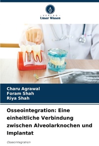 Enlarge image Cover: Osseointegration - Verlag Unser Wissen