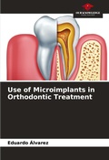 Cover: Use of Microimplants in Orthodontic Treatment - Our Knowledge Publishing