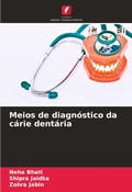 Cover: Meios de diagnostico da carie dentaria - Edicoes Nosso Conhecimento