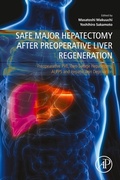 Abbildung von: Safe Major Hepatectomy after Preoperative Liver Regeneration - Academic Press