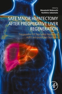 Abbildung von: Safe Major Hepatectomy after Preoperative Liver Regeneration - Academic Press