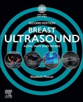 Cover: Breast Ultrasound - Churchill Livingstone