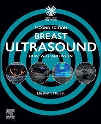 Enlarge image Cover: Breast Ultrasound - Churchill Livingstone