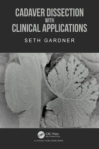 Abbildung von: Cadaver Dissection with Clinical Applications - CRC Press