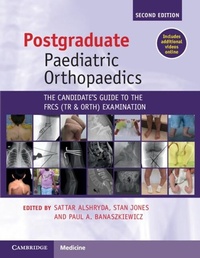 Abbildung von: Postgraduate Paediatric Orthopaedics - Cambridge University Press