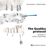 Abbildung von: The Quokka protocol - Quintessence international