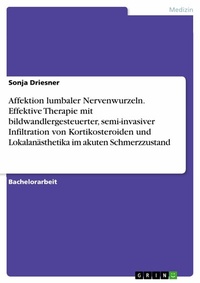 Abbildung von: Affektion lumbaler Nervenwurzeln. Effektive Therapie mit bildwandlergesteuerter, semi-invasiver Infiltration von Kortikosteroiden und Lokalanästhetika im akuten Schmerzzustand - GRIN Verlag