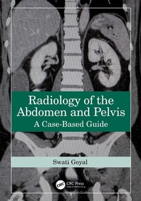 Abbildung von: Radiology of the Abdomen and Pelvis - CRC Press